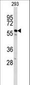 Cell Division Cycle 14B antibody, LS-C168581, Lifespan Biosciences, Western Blot image 