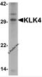 Kallikrein Related Peptidase 4 antibody, 7445, ProSci, Western Blot image 