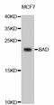 BCL2 Associated Agonist Of Cell Death antibody, STJ112649, St John