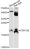 Crystallin Gamma B antibody, LS-C749568, Lifespan Biosciences, Western Blot image 