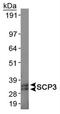 Synaptonemal Complex Protein 3 antibody, NB300-232, Novus Biologicals, Western Blot image 