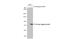 His tag antibody, GTX628921, GeneTex, Western Blot image 