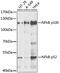 Nuclear Factor Kappa B Subunit 2 antibody, 19-737, ProSci, Western Blot image 