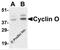 Cyclin O antibody, 3861, ProSci Inc, Western Blot image 