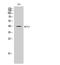 Solute Carrier Family 16 Member 13 antibody, A15471, Boster Biological Technology, Western Blot image 