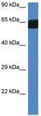 Flavin Containing Dimethylaniline Monoxygenase 3 antibody, TA335296, Origene, Western Blot image 