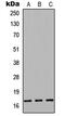 Cystatin 9 Like antibody, abx121584, Abbexa, Western Blot image 