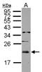 Ubiquitin Conjugating Enzyme E2 E3 antibody, NBP2-20784, Novus Biologicals, Western Blot image 