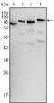 B-Raf Proto-Oncogene, Serine/Threonine Kinase antibody, NBP1-47433, Novus Biologicals, Western Blot image 