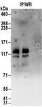 Diphosphoinositol Pentakisphosphate Kinase 2 antibody, NBP2-32155, Novus Biologicals, Immunoprecipitation image 