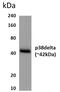 Mitogen-Activated Protein Kinase 13 antibody, GTX52959, GeneTex, Western Blot image 