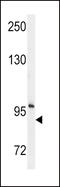 Ectonucleotide Pyrophosphatase/Phosphodiesterase 2 antibody, 61-553, ProSci, Western Blot image 