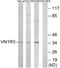 Vomeronasal 1 Receptor 3 (Gene/Pseudogene) antibody, A17618, Boster Biological Technology, Western Blot image 