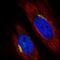 Beta-1,4-Galactosyltransferase 1 antibody, HPA010806, Atlas Antibodies, Immunofluorescence image 