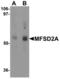 Major Facilitator Superfamily Domain Containing 2A antibody, LS-B5348, Lifespan Biosciences, Western Blot image 