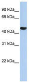 Zinc Finger Protein 286A antibody, TA339517, Origene, Western Blot image 