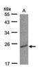 UMP-CMP kinase antibody, PA5-28268, Invitrogen Antibodies, Western Blot image 