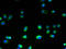 Transmembrane Protein 106A antibody, A61358-100, Epigentek, Immunofluorescence image 