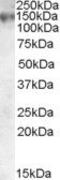 ATP Binding Cassette Subfamily C Member 1 antibody, PA5-18973, Invitrogen Antibodies, Western Blot image 