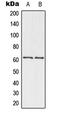 Checkpoint Kinase 2 antibody, MBS822146, MyBioSource, Western Blot image 