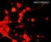 PKC antibody, PM2421, ECM Biosciences, Immunocytochemistry image 