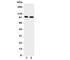 Transient Receptor Potential Cation Channel Subfamily V Member 4 antibody, R31085, NSJ Bioreagents, Western Blot image 