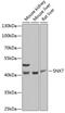 Sorting Nexin 7 antibody, GTX66504, GeneTex, Western Blot image 