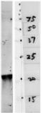 Parkinsonism Associated Deglycase antibody, LS-B12771, Lifespan Biosciences, Western Blot image 