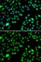 L3MBTL Histone Methyl-Lysine Binding Protein 3 antibody, GTX32696, GeneTex, Immunofluorescence image 