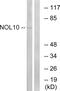 Nucleolar Protein 10 antibody, GTX87965, GeneTex, Western Blot image 