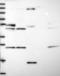 Cytochrome P450 Family 2 Subfamily R Member 1 antibody, NBP2-13895, Novus Biologicals, Western Blot image 