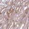 SPATA31 Subfamily D Member 1 antibody, NBP2-14623, Novus Biologicals, Immunohistochemistry paraffin image 