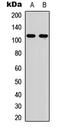 Ephrin type-A receptor 6 antibody, LS-B14564, Lifespan Biosciences, Western Blot image 