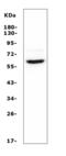 Acid Sensing Ion Channel Subunit 1 antibody, A02332-2, Boster Biological Technology, Western Blot image 