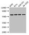 Interferon Regulatory Factor 5 antibody, CSB-PA011820LA01HU, Cusabio, Western Blot image 