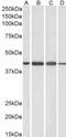 ArfGAP With Dual PH Domains 1 antibody, PA5-18206, Invitrogen Antibodies, Western Blot image 