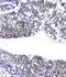 Replication Protein A1 antibody, M01317-2, Boster Biological Technology, Immunohistochemistry paraffin image 