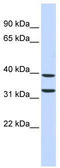 Zinc Finger Protein 177 antibody, TA343404, Origene, Western Blot image 
