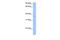 TREML2 antibody, GTX45970, GeneTex, Western Blot image 