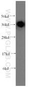 Retinol Dehydrogenase 13 antibody, 16067-1-AP, Proteintech Group, Western Blot image 
