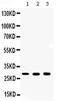 Carbonic Anhydrase 2 antibody, PA5-78897, Invitrogen Antibodies, Western Blot image 