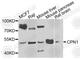Carboxypeptidase N Subunit 1 antibody, A7887, ABclonal Technology, Western Blot image 