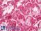 Branched Chain Keto Acid Dehydrogenase E1 Subunit Alpha antibody, LS-B12367, Lifespan Biosciences, Immunohistochemistry paraffin image 