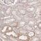 Zinc Finger Protein 852 antibody, NBP2-14804, Novus Biologicals, Immunohistochemistry paraffin image 