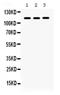 Integrin Subunit Alpha 2b antibody, PA5-79527, Invitrogen Antibodies, Western Blot image 