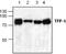 Hydroxyacyl-CoA Dehydrogenase Trifunctional Multienzyme Complex Subunit Alpha antibody, GTX59891, GeneTex, Western Blot image 