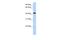 Transcriptional Adaptor 1 antibody, A13446, Boster Biological Technology, Western Blot image 