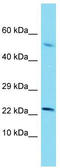 Nuclear LIM interactor-interacting factor 2 antibody, TA342201, Origene, Western Blot image 