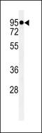 Macoilin 1 antibody, 61-728, ProSci, Western Blot image 