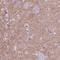 Solute Carrier Family 12 Member 5 antibody, NBP2-49674, Novus Biologicals, Immunohistochemistry frozen image 